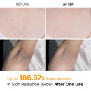 Get Smoother, Brighter Skin From The First Use — At Home Body Peeling Spray