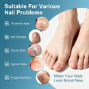 Professional Antifungal Nail Repair Pen – High-Strength Recovery Formula