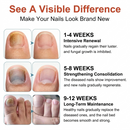 Professional Antifungal Nail Repair Pen – High-Strength Recovery Formula